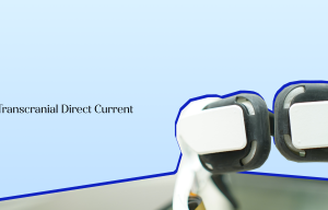 HD-tDCS: Revolutionizing Brain Therapy & Wellness